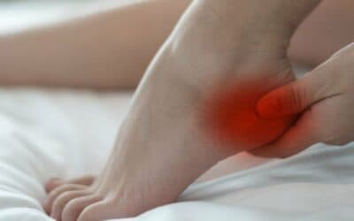 Blog 2 Heel Spurs: What are they and what can I do to get rid of them?