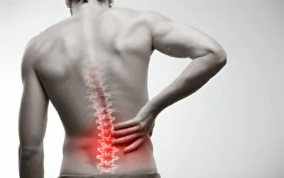 Managing Chronic Low Back Pain with Chiropractic Care and Physiotherapy